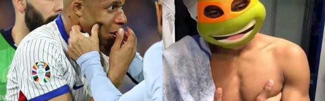 开云登录-【盘点】断鼻姆巴佩将解锁新皮肤，细数足坛“面具侠”