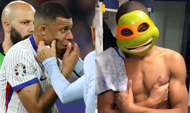 开云登录-【盘点】断鼻姆巴佩将解锁新皮肤，细数足坛“面具侠”